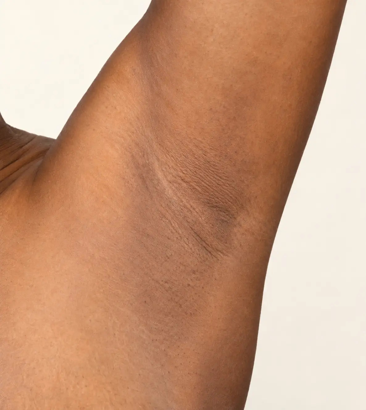 Before and after results showing lightened underarms and smoother skin texture from using Lulu's Holistics Lemon and Turmeric Even-Tone Deodorant